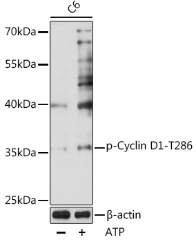 Anti-Phospho-CCND1-T286 Antibody (CABP0574)