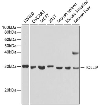 Anti-TOLLIP Antibody (CAB2202)