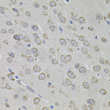 Anti-MYO10 Antibody (CAB12471)