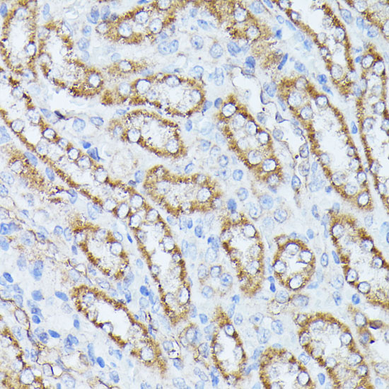 Anti-PPP2CB Antibody (CAB3122)