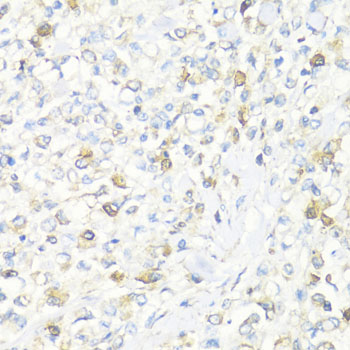 Anti-EIF3J Polyclonal Antibody (CAB8637)