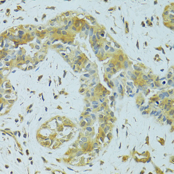 Anti-MTCH1 Polyclonal Antibody (CAB8063)