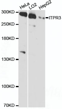 Anti-ITPR3 Antibody (CAB12794)