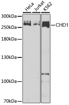 Anti-CHD1 Antibody [KO Validated] (CAB7883)