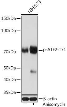 Anti-Phospho-ATF2-T71 Antibody (CABP1051)