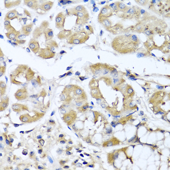 Anti-Interferon lambda-1 Polyclonal Antibody (CAB8288)