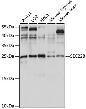 Anti-SEC22B Antibody (CAB15358)