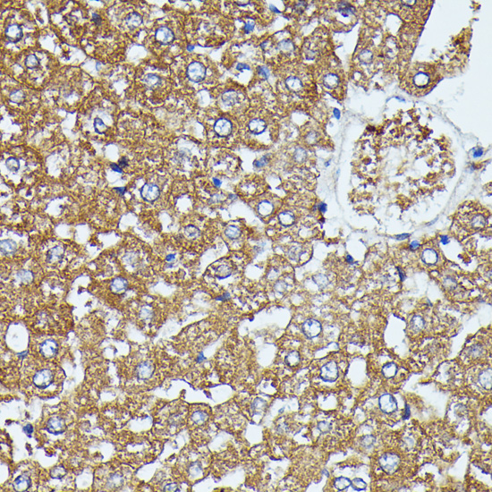 Anti-SAA4 Antibody (CAB16428)