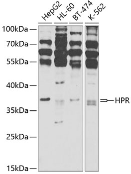 Anti-HPR Polyclonal Antibody (CAB9898)