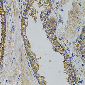 Anti-PIK3C3 Antibody (CAB0952)