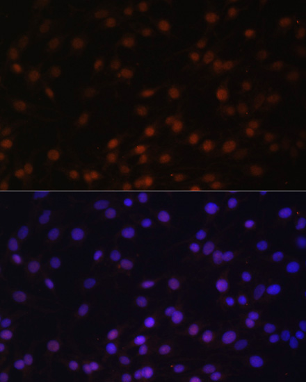 Anti-ZNF177 Antibody (CAB14802)