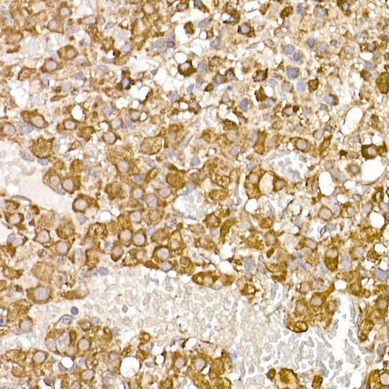 Immunohistochemistry of paraffin-embedded rat ovary using UQCRH Rabbit mAb at dilution of 1:50 (40x lens). Perform high pressure antigen retrieval with 10 mM citrate buffer pH 6. 0 before commencing with IHC staining protocol.