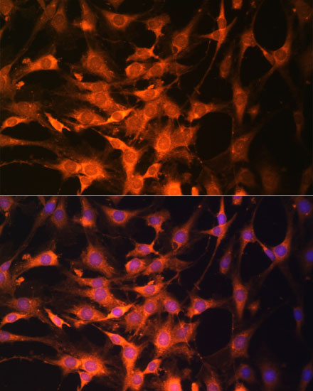 Anti-PTEN Antibody (CAB2113)