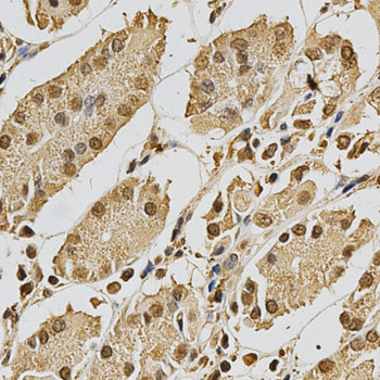 Anti-XRCC3 Antibody (CAB2134)