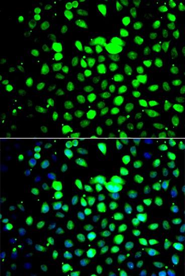 Anti-ZBTB25 Antibody (CAB7501)