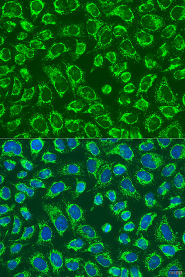 Anti-MAP4K5 Antibody (CAB15139)