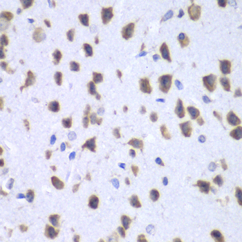 Anti-UPF1 Antibody (CAB13541)