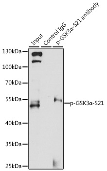 Anti-Phospho-GSK3A-S21 Antibody (CABP0582)