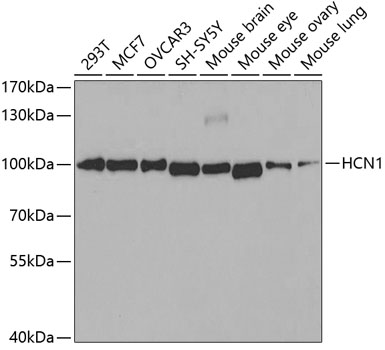 Anti-HCN1 Antibody (CAB2969)