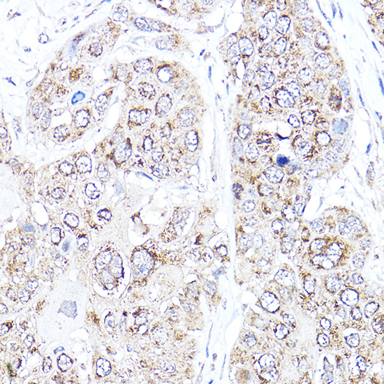 Anti-VEGF Antibody (CAB12303)