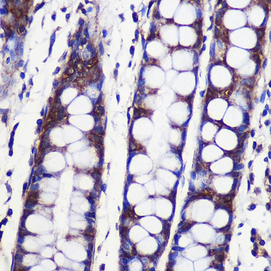 Anti-SPPL2A Antibody (CAB15539)