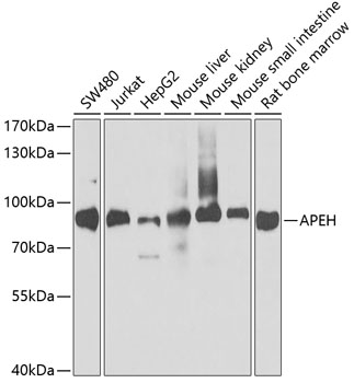 Anti-APEH Antibody (CAB5893)