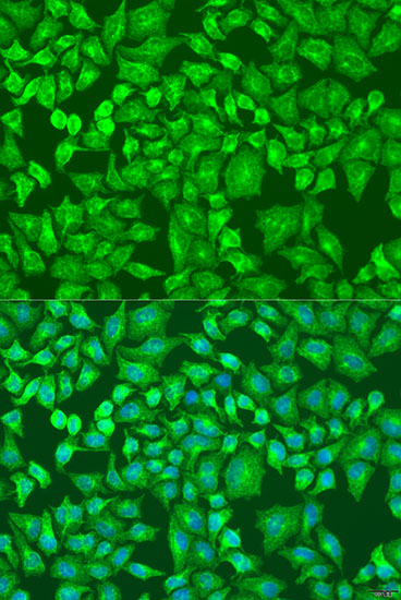 Anti-DVL2 Antibody (CAB14726)