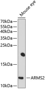 Anti-ARMS2 Antibody (CAB10161)