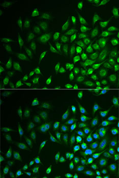 Anti-LNX1 Antibody (CAB6481)