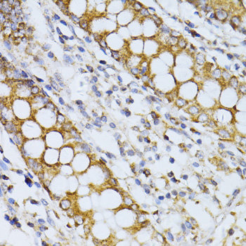 Anti-CCDC92 Polyclonal Antibody (CAB8262)