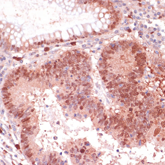 Anti-S100P Antibody (CAB14780)