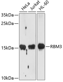 Anti-RBM3 Antibody (CAB5931)