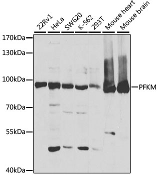 Anti-PFKM Antibody (CAB5477)