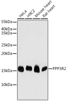 Anti-PPP3R2 Antibody (CAB7495)