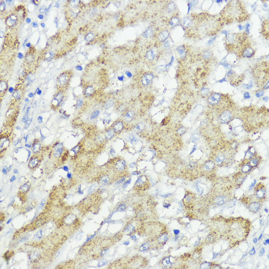 Anti-SOCS6 Polyclonal Antibody (CAB9957)