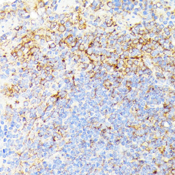 Anti-RIPK1 Antibody (CAB7414)