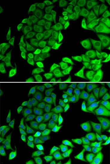 Anti-RPL14 Antibody (CAB13384)