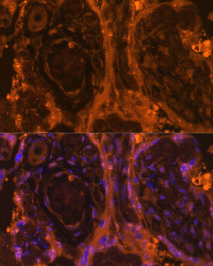 Anti-TEK Antibody (CAB7222)