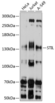 Anti-STIL Antibody (CAB10350)