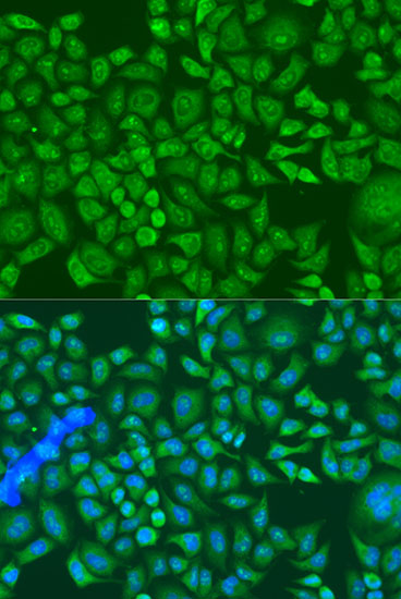 Anti-IGF2BP2 Antibody (CAB14103)