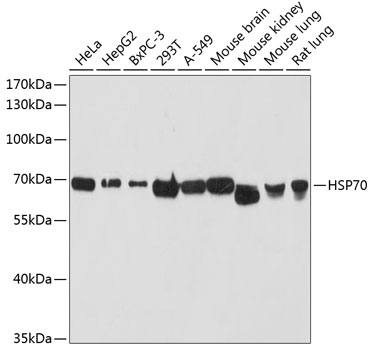 Anti-HSP70 Antibody (CAB12948)