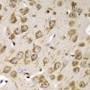 Anti-TMED10 Antibody (CAB6771)