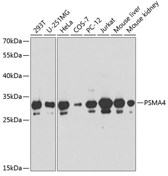 Anti-PSMA4 Antibody (CAB13535)