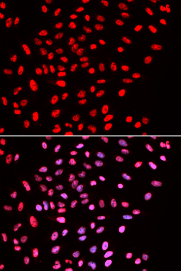 Anti-SMARCE1 Antibody (CAB5361)