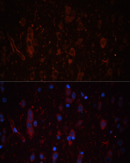 Anti-LAMC1 Antibody (CAB16020)