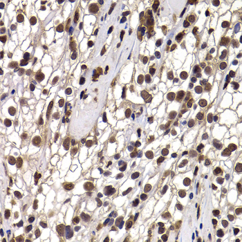 Anti-DDX21 Antibody (CAB7034)