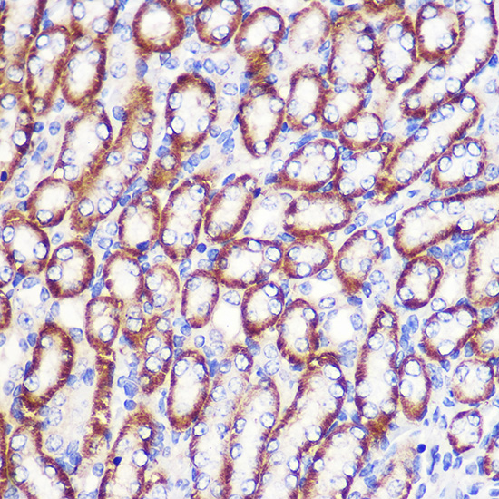 Anti-LDHA Antibody (CAB18574)