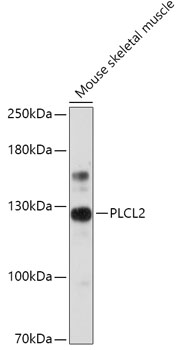 Anti-PLCL2 Antibody (CAB17660)