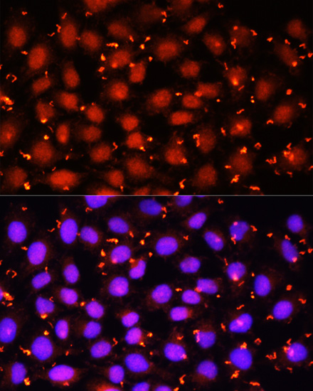 Anti-ACAA1 Antibody (CAB15018)