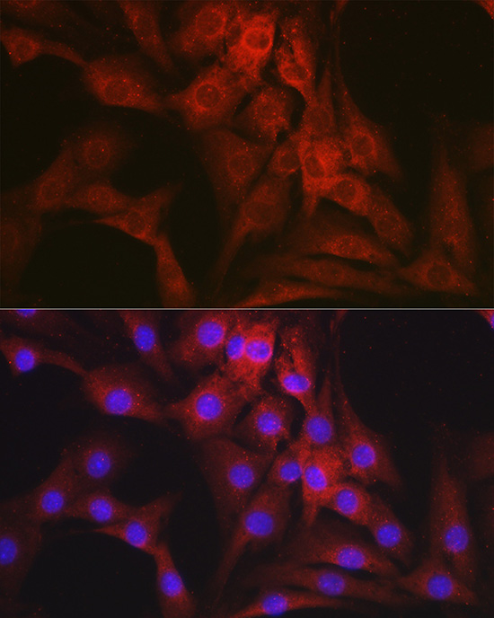 Anti-NR3C2 Antibody (CAB3308)